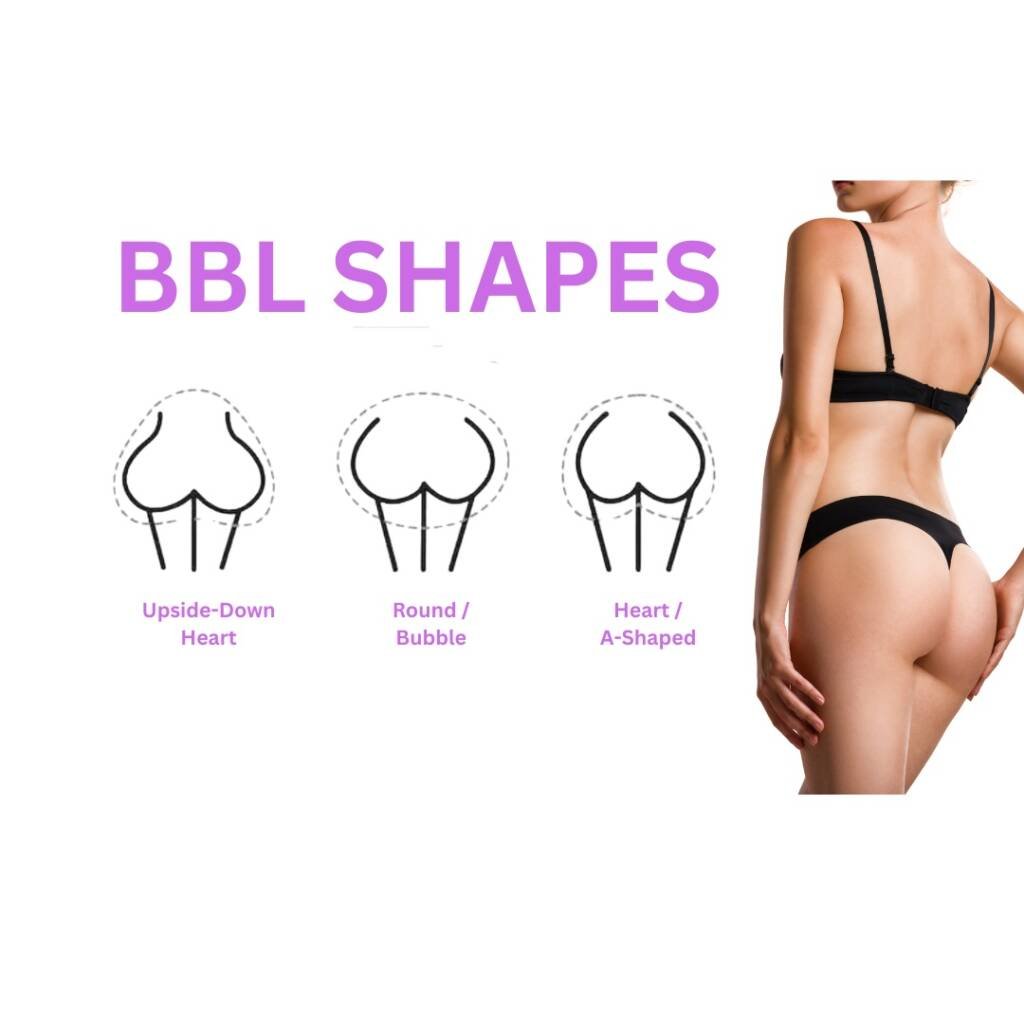 bbl shapes