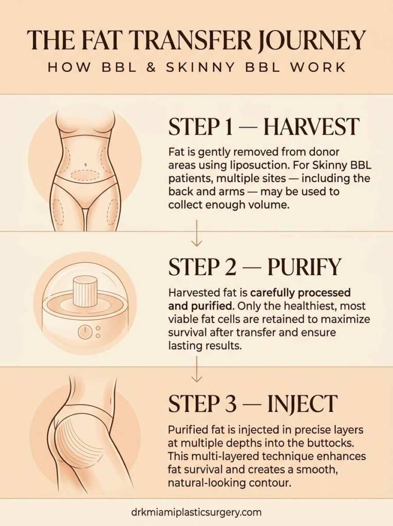Three-step fat transfer process for BBL and Skinny BBL procedures at Dr. K Miami Plastic Surgery