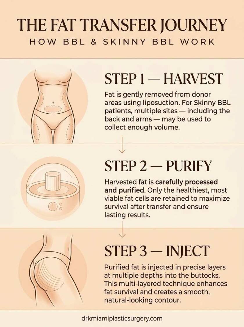 BBL vs Skinny BBL: Differences in Buttocks Augmentation