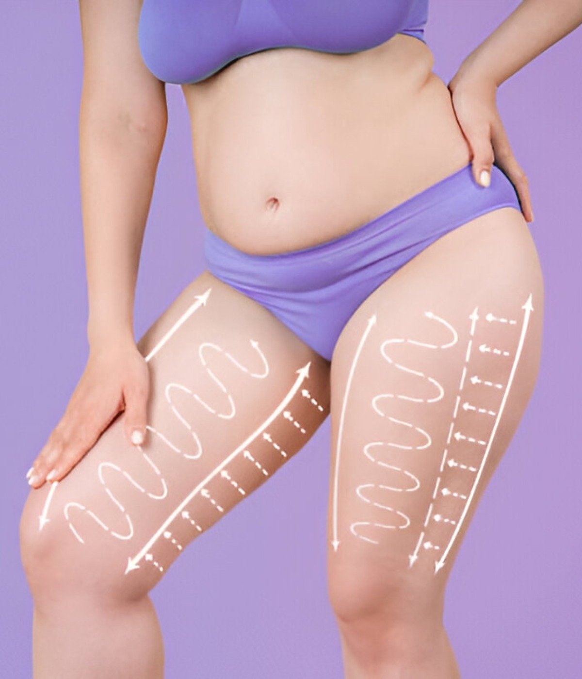 Legs and buttocks liposuction