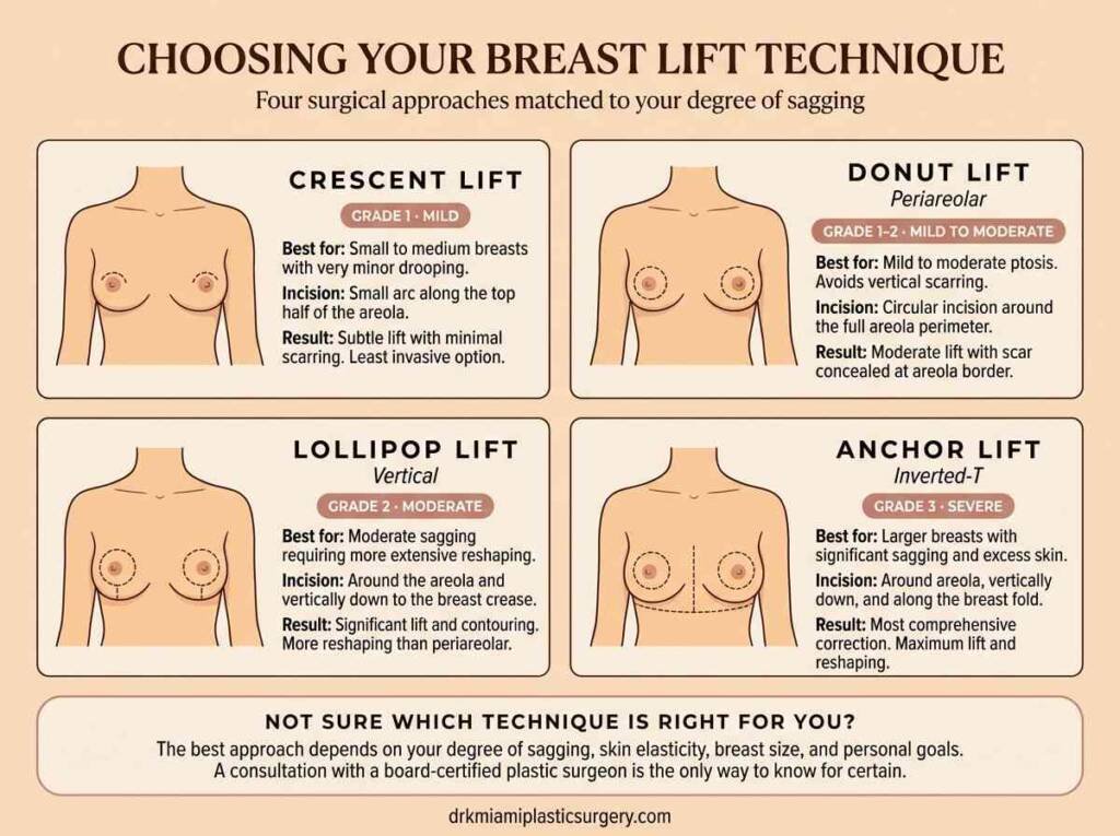 Comparison chart of four breast lift techniques: Crescent, Donut, Lollipop, and Anchor lifts