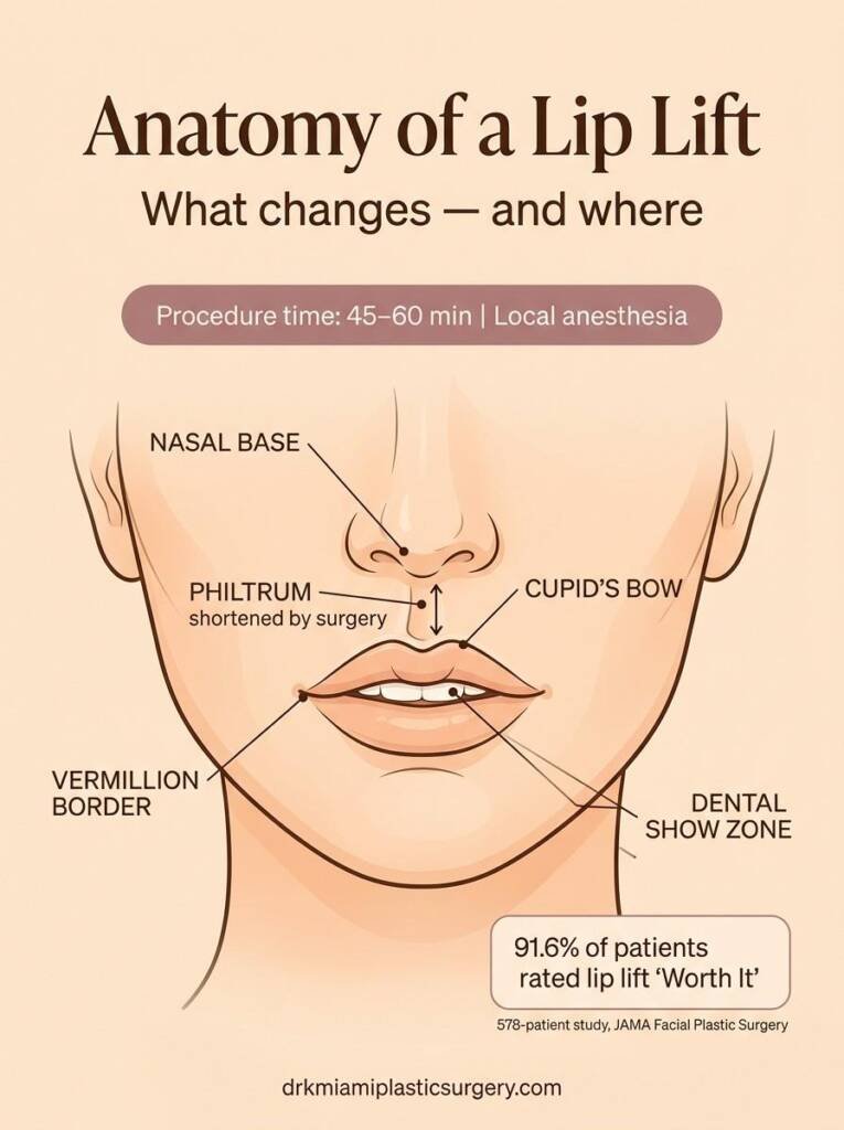 Anatomical diagram labeling the philtrum, cupid's bow, nasal base, and dental show zone for lip lift surgery