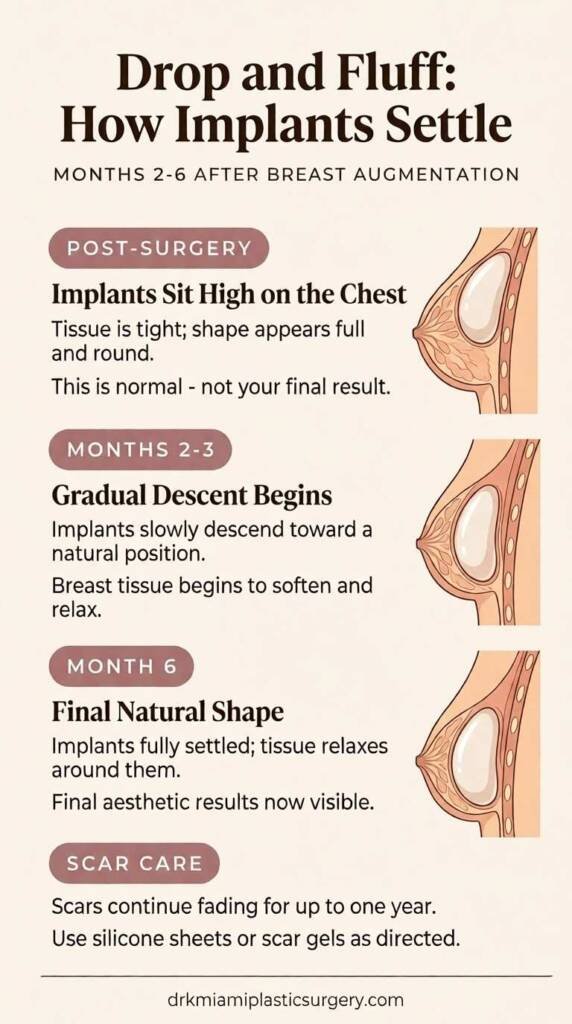 How breast implants settle from post-surgery to month six